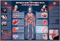 Электрифицированный стенд "Вредные привычки: алкоголизм" - fgospostavki.ru - Артём