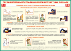 Таблица "Порядок действий при опасном кровотечении" (100х140 сантиметров, винил) - fgospostavki.ru - Артём