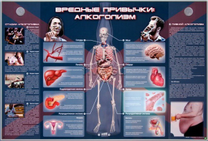 Электрифицированный стенд "Вредные привычки: алкоголизм" - fgospostavki.ru - Артём